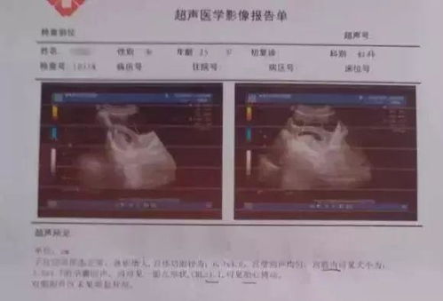 成绩查询系统b超,精准定位学业健康